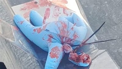 باسلوب تهديدي جديد... قفازات دم فوق ميس الجبل