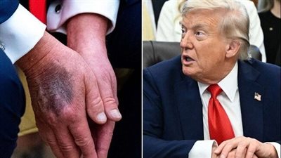 مسؤول أميركي بعد إشاعات حول صحة ترامب: ترامب بخير وسيخرج للعب الغولف هذا الصباح