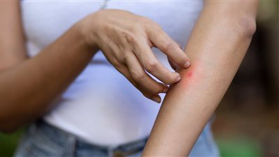 الملاريا تعود إلى لبنان... هل من داعٍ للهلع؟